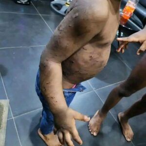 Woman And Her Partner Arrested For Allegedly Battering Her Two Children In Lagos