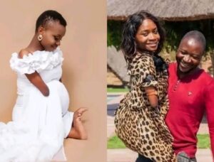 Zimbabwean woman born without limbs expecting first child with her husband