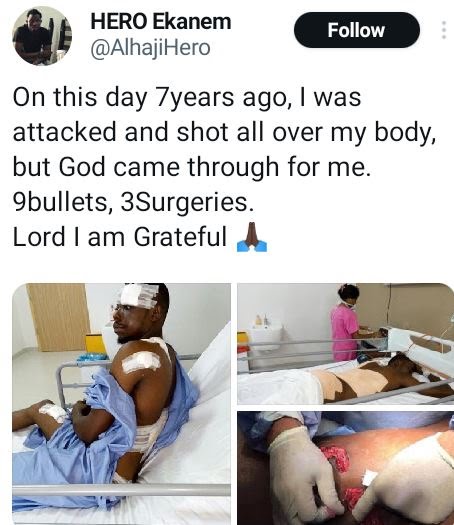 9 Bullets, 3 Surgeries – Nigerian Man Marks Seven Years Since He Survived Armed Robbery Attack